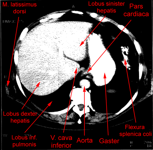 anatomia radiologiczna - 2.gif